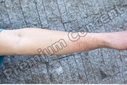 Forearm Man White Average